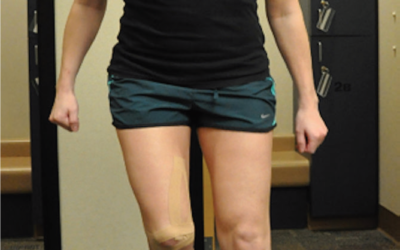 Taping does not alter PFJ alignment or contact area