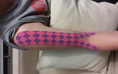 Kinesiology tape for recovery – reducing DOMS