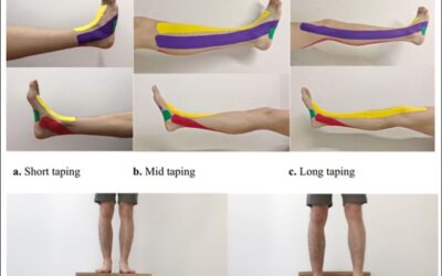 Kinesiology taping may assist with ankle proprioception impairments.