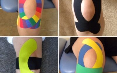 Kinesiology tape is helpful to reduce anterior knee pain