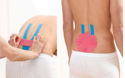 Adding kinesiology tape to your low back exercise regime may give you better improvements than exercise alone